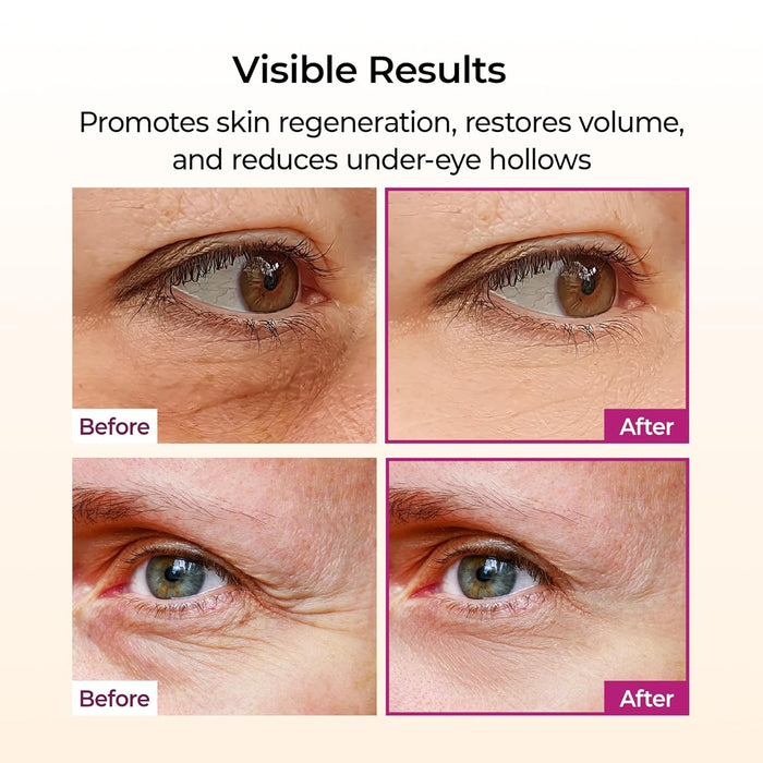 Dr.Melaxin - Calcium Volume Multi Balm