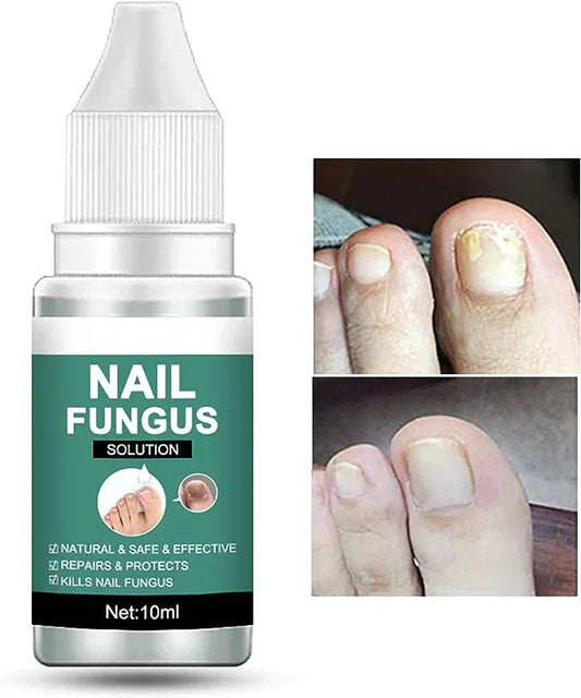 Nail Fungus Remover